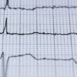 Omceo: “Ancora un successo per la Cardiologia al San Giovanni di Dio”