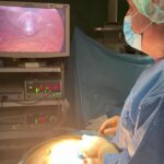 Ospedale di Licata, carcinosi peritoneale trattata con l’innovativa tecnica PIPAC